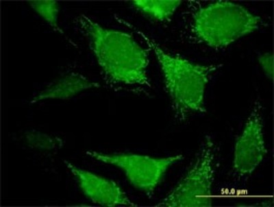 Immunocytochemistry/Immunofluorescence: DECR2 Antibody (4A7) [H00026063-M03] - Analysis of monoclonal antibody to DECR2 on HeLa cell. Antibody concentration 10 ug/ml