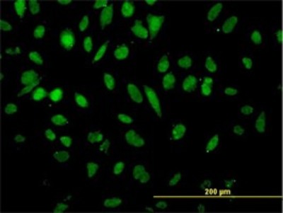 Immunocytochemistry/Immunofluorescence: NFX1 Antibody (1D12) [H00004799-M01] - Analysis of monoclonal antibody to NFX1 on HeLa cell. Antibody concentration 30 ug/ml.