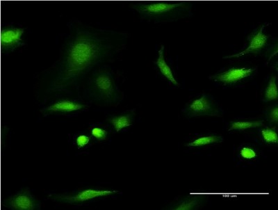 Immunocytochemistry/Immunofluorescence: C1D Antibody (4H5) [H00010438-M10] - Analysis of monoclonal antibody to C1D on HeLa cell. Antibody concentration 10 ug/ml
