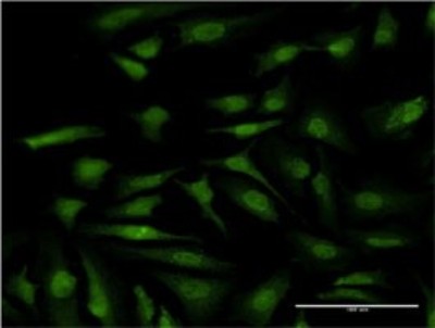 Immunocytochemistry/Immunofluorescence: ATP6V1E1 Antibody (4E11) [H00000529-M02] - Analysis of monoclonal antibody to ATP6V1E1 on HeLa cell. Antibody concentration 10 ug/ml.