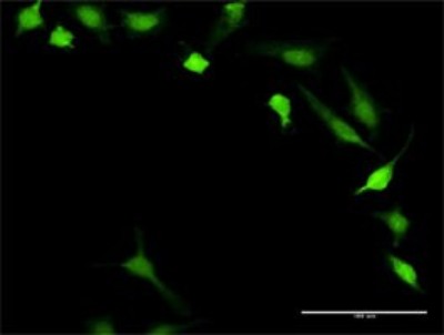Immunocytochemistry/Immunofluorescence: Calcineurin B Antibody [H00005534-D01P] - Analysis of antibody to PPP3R1 on HeLa cell. Antibody concentration 10 ug/ml.