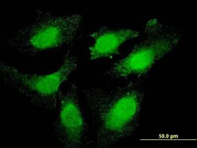 Immunocytochemistry/Immunofluorescence: Topo III beta Antibody (1H4) [H00008940-M04] - Analysis of monoclonal antibody to TOP3B on HeLa cell. Antibody concentration 10 ug/ml
