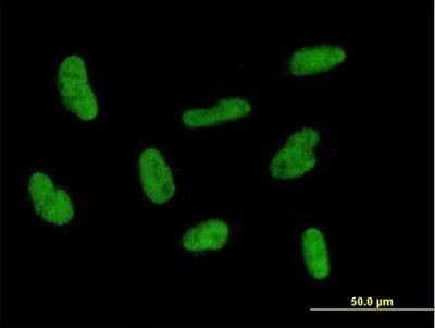 Immunocytochemistry/Immunofluorescence: GTF2H2 Antibody [H00002966-B01P] - Analysis of purified antibody to GTF2H2 on HepG2 cell. (antibody concentration 10 ug/ml)