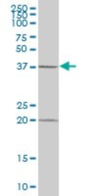 Western Blot: MAP3K12 binding inhibitory protein 1 Antibody [H00051562-B01P] - Analysis of MBIP expression in human pancreas.