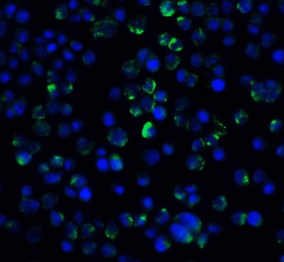 Immunocytochemistry/Immunofluorescence: IL-21 R Antibody [NBP1-76456] - Staining of IL-21 Receptor in A431 cells with IL-21 Receptor antibody at 20 ug/ml.