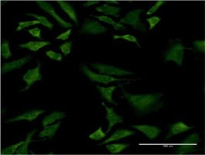 Immunocytochemistry/Immunofluorescence: SMN2 Antibody (1A3-2B9) [H00006607-M02] - Analysis of monoclonal antibody to SMN2 on HeLa cell. Antibody concentration 10 ug/ml.