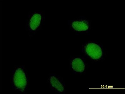 Immunocytochemistry/Immunofluorescence: VGLL1 Antibody [H00051442-B02P] - Analysis of purified antibody to VGLL1 on HeLa cell. (antibody concentration 10 ug/ml)