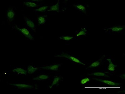 Immunocytochemistry/Immunofluorescence: NFAT5 Antibody [H00010725-B01P] - Analysis of purified antibody to NFAT5 on HeLa cell. (antibody concentration 30 ug/ml)