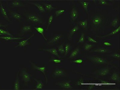 Immunocytochemistry/Immunofluorescence: ESF1 Antibody [H00051575-D01P] - Analysis of antibody to ESF1 on HeLa cell. Antibody concentration 10 ug/ml.