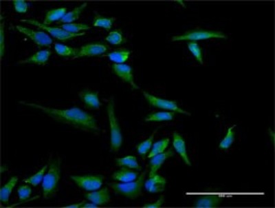 Immunocytochemistry/Immunofluorescence: INPP5B Antibody [H00003633-D01P] - Analysis of antibody to INPP5B on HeLa cell. Antibody concentration 30 ug/ml.