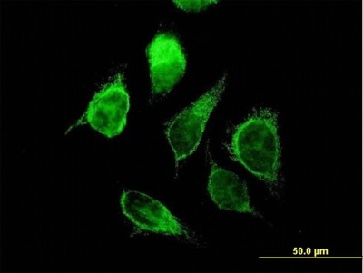 Immunocytochemistry/Immunofluorescence: ECHS1 Antibody [H00001892-B01P] - Analysis of purified antibody to ECHS1 on HeLa cell. (antibody concentration 10 ug/ml)