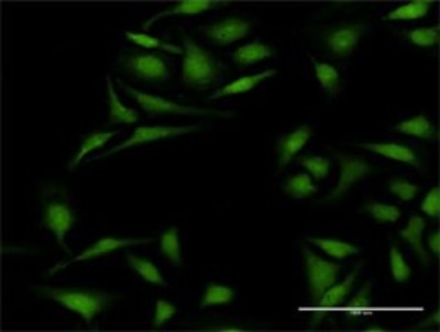 Immunocytochemistry/Immunofluorescence: Cytokeratin 12 Antibody [H00003859-D01P] - Analysis of antibody to KRT12 on HeLa cell. Antibody concentration 20 ug/ml.