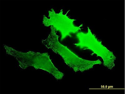Immunocytochemistry/Immunofluorescence: GUCY2D Antibody (7E5) [H00003000-M07] - Analysis of monoclonal antibody to GUCY2D on HeLa cell. Antibody concentration 10 ug/ml