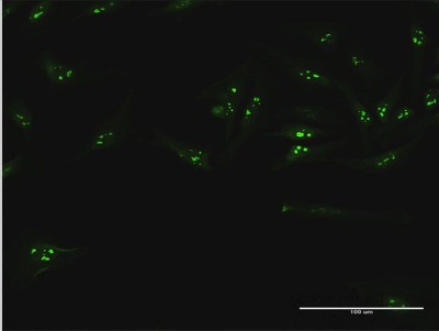 Immunocytochemistry/Immunofluorescence: UTP18 Antibody [H00051096-B01P] - Analysis of purified antibody to UTP18 on HeLa cell. (antibody concentration 10 ug/ml)