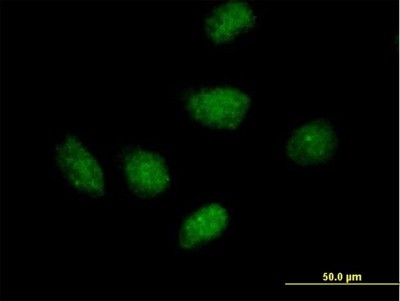 Immunocytochemistry/Immunofluorescence: RPAIN Antibody [H00084268-B01P] - Analysis of purified antibody to RIP on HeLa cell. (antibody concentration 10 ug/ml)