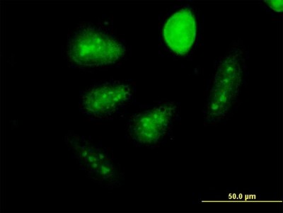 Immunocytochemistry/Immunofluorescence: GCM1 Antibody (3D3) [H00008521-M06] - Analysis of monoclonal antibody to GCM1 on HeLa cell. Antibody concentration 10 ug/ml