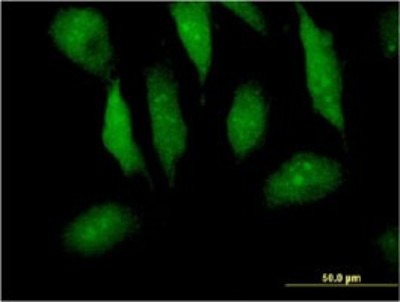 Immunocytochemistry/Immunofluorescence: Myotrophin Antibody (1F3) [H00136319-M14] - Analysis of monoclonal antibody to MTPN on HeLa cell. Antibody concentration 10 ug/ml