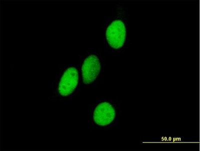 Immunocytochemistry/Immunofluorescence: ORC4L Antibody [H00005000-B01P] - Analysis of purified antibody to ORC4L on HeLa cell. (antibody concentration 10 ug/ml)