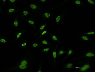 Immunocytochemistry/Immunofluorescence: RERE Antibody (2F2) [H00000473-M06] - Analysis of monoclonal antibody to RERE on HeLa cell. Antibody concentration 10 ug/ml