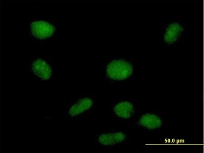 Immunocytochemistry/Immunofluorescence: PHF19 Antibody [H00026147-B01P] - Analysis of purified antibody to PHF19 on HeLa cell. (antibody concentration 10 ug/ml)