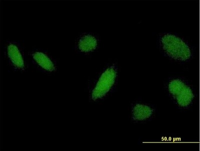 Immunocytochemistry/Immunofluorescence: DHRSX Antibody [H00207063-B01P] - Analysis of purified antibody to DHRSX on HeLa cell. (antibody concentration 10 ug/ml)