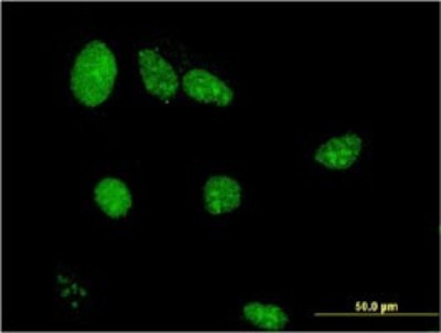 Immunocytochemistry/Immunofluorescence: LIMD1 Antibody (2G5) [H00008994-M01] - Analysis of monoclonal antibody to LIMD1 on HeLa cell. Antibody concentration 10 ug/ml.