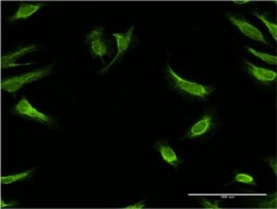 Immunocytochemistry/Immunofluorescence: RBP7 Antibody (4F4) [H00116362-M01] - Analysis of monoclonal antibody to RBP7 on HeLa cell. Antibody concentration 10 ug/ml.