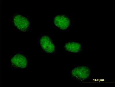 Immunocytochemistry/Immunofluorescence: MCM10 Antibody [H00055388-B01P] - Analysis of purified antibody to MCM10 on HeLa cell. (antibody concentration 10 ug/ml)