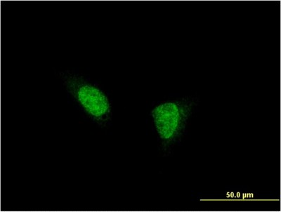 Immunocytochemistry/Immunofluorescence: Teashirt homolog 1 Antibody (2F1) [H00010194-M07] - Analysis of monoclonal antibody to TSHZ1 on HeLa cell. Antibody concentration 10 ug/ml