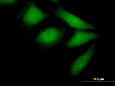 Immunocytochemistry/Immunofluorescence: NEDD9/CASL/HEF1 Antibody [H00004739-B01P] - Analysis of purified antibody to NEDD9 on HeLa cell. (antibody concentration 10 ug/ml)