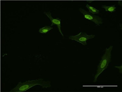 Immunocytochemistry/Immunofluorescence: BATF3 Antibody (3H1) [H00055509-M04] - Analysis of monoclonal antibody to BATF3 on HeLa cell. Antibody concentration 10 ug/ml