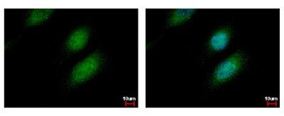 Immunocytochemistry/Immunofluorescence: UBE2A Antibody [NBP2-20780] - Sample: HeLa cells were fixed in 4% paraformaldehyde at RT for 15 min. Green: UBE2A protein stained by UBE2A antibody diluted at 1:500. Blue: Hoechst 33342 staining.