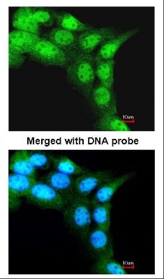 Immunocytochemistry/Immunofluorescence: FBXL3 Antibody [NBP1-32979] - Paraformaldehyde-fixed A431, using NBP1-32979.