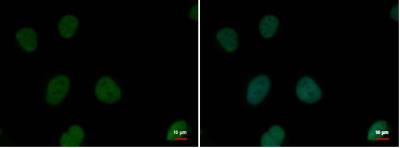 Immunocytochemistry/Immunofluorescence: RPA2 Antibody [NB100-157] - HeLa cells were fixed in 4% paraformaldehyde at RT for 15 min. Green: RPA32 protein stained by RPA32 antibody  diluted at 1:500. Blue: Hoechst 33342 staining.