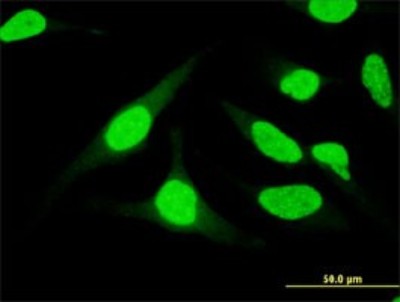Immunocytochemistry/Immunofluorescence: UBASH3B/STS1/Tula-2 Antibody (3G7) [H00084959-M01] - Analysis of monoclonal antibody to UBASH3B on HeLa cell. Antibody concentration 10 ug/ml.