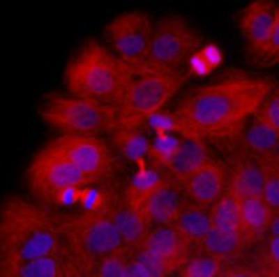 Immunocytochemistry/Immunofluorescence: beta II Tubulin B Antibody (AT5B2) [NBP1-74037] - Immunofluorescence of HaCaT cells stained with Hoechst 3342 (Blue) for nucleus staining and monoclonal anti-human beta-Tubulin antibody (1:1000) with Texas Red (Red).