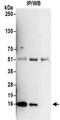 Western Blot: PCNA associated factor Antibody [NBP2-32117] - Whole cell lysate (0.5 or 1.0 mg per IP reaction; 20% of IP loaded) prepared using RIPA buffer from HeLa cells.  Antibodies:  Affinity purified rabbit anti-PAF antibody NBP2-32117 used for IP at 6 ug per reaction.  PAF was also immunoprecipitated by rabbit anti-PAF antibody NBP2-32117.  For blotting immunoprecipitated PAF, NBP2-32117 was used at 1 ug/ml.  Detection: Chemiluminescence with an exposure time of 3 minutes.
