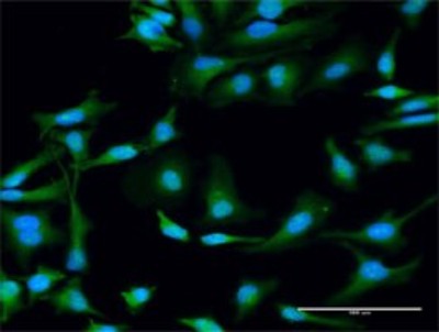 Immunocytochemistry/Immunofluorescence: STX11 Antibody [H00008676-D01P] - Analysis of antibody to STX11 on HeLa cell. Antibody concentration 30 ug/ml.