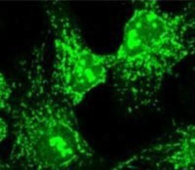 Immunocytochemistry/Immunofluorescence: alpha COP I Antibody [NB120-2913] - HeLa cells.