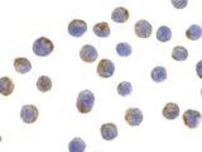 Immunocytochemistry/Immunofluorescence: LAMP-2/CD107b Antibody [NBP1-76653] - HepG2 cells with LAMP-2 antibody at 10 ug/ml.
