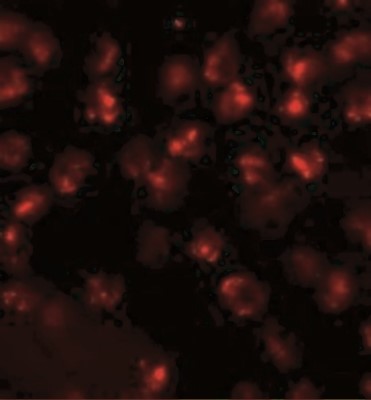 Immunocytochemistry/Immunofluorescence: ATP2C2 Antibody [NBP1-76567] - Immunofluorescence of ATP2C2 in 3T3 cells with ATP2C2 antibody at 20 ug/mL.
