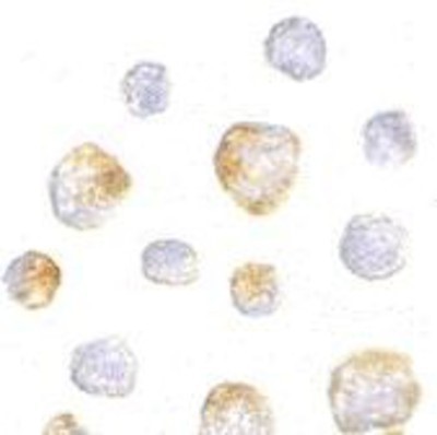 Immunocytochemistry/Immunofluorescence: Kinesin 5A Antibody [NBP1-76817] - K562 cells with Kinesin 5A antibody at 5 ug/ml.