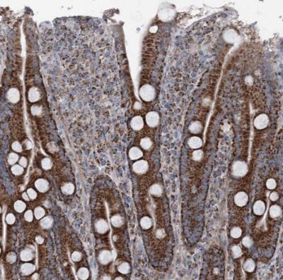 Immunohistochemistry-Paraffin: Urocortin 3 Antibody [NBP1-80732] - Staining of human duodenum shows strong granular cytoplasmic positivity in glandular cells.