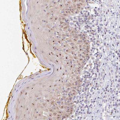 Immunohistochemistry-Paraffin: Nucleoporin NUP85/Pericentrin 1 Antibody [NBP2-31860] - Pericentrin 1 Antibody [NBP2-31860] - Staining of human oral mucosa shows moderate nucleolar positivity in squamous epithelial cells.