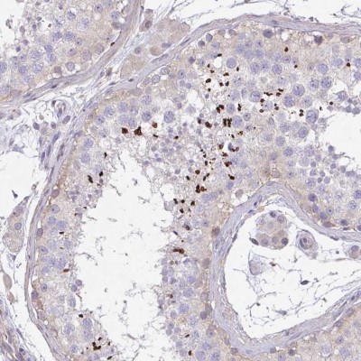 Immunohistochemistry: C19orf54 Antibody [NBP2-32485] - Staining of human testis shows strong nuclear positivity in a subset of cells in seminiferus ducts.