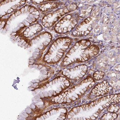 Immunohistochemistry: V-type proton ATPase subunit F Antibody [NBP2-38587] - Staining of human stomach, upper shows strong cytoplasmic positivity in glandular cells.