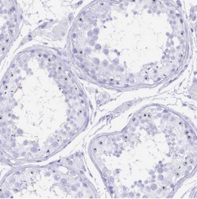 Immunohistochemistry: C12orf56 Antibody [NBP2-30788] - Staining of human testis shows moderate nucleolar positivity in cells in seminiferus ducts.