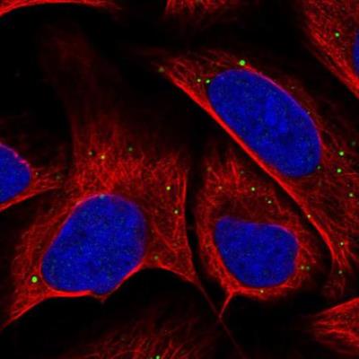 Immunocytochemistry/Immunofluorescence: EMID2 Antibody [NBP2-59788] - Immunofluorescent staining of human cell line U-2 OS shows localization to vesicles. Antibody staining is shown in green.