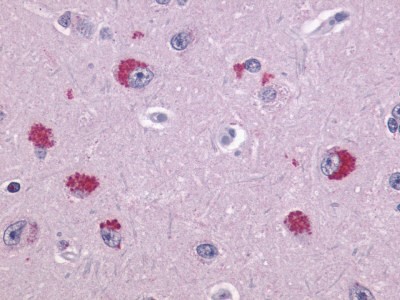 Immunohistochemistry-Paraffin: Trace Amine Receptor 1 Antibody [NLS2042] - Analysis of anti-TAAR1 antibody with human brain, neurons at 6 ug/ml.