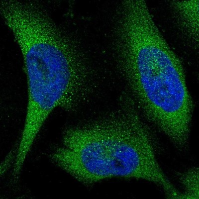Immunocytochemistry/Immunofluorescence: KLHL28 Antibody [NBP1-90748] - Immunofluorescent staining of human cell line U-251 MG shows localization to cytosol.